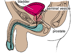 Cavernous Nerve, Sural Nerve Graft, Impotence, Incontenence, Erectile Dysfunction, Erectile Disfunction , Prostate Nerve Surgery, Nerve Surgery, Sural Nerve Graft, Rahul Nath, prostate nerve injury, prostate nerve surgeon